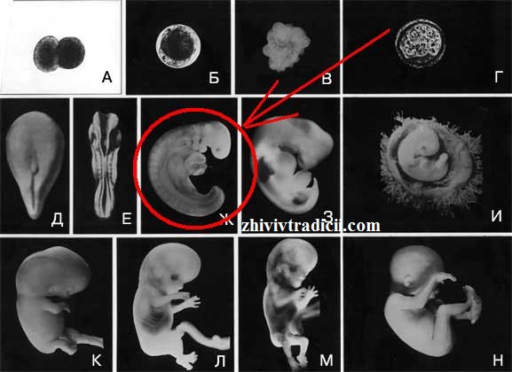 На фото роидное включение у ребенка на 4-5 неделе после зачатия. Раньше лет 200 назад - этого не было!